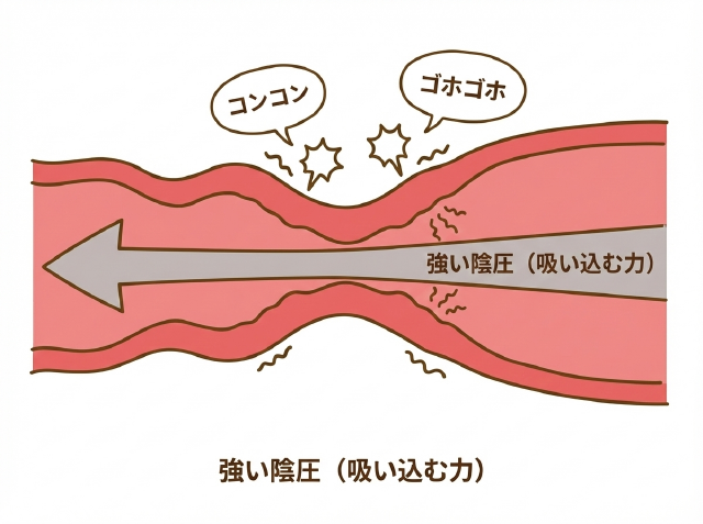 睡眠時無呼吸症候群