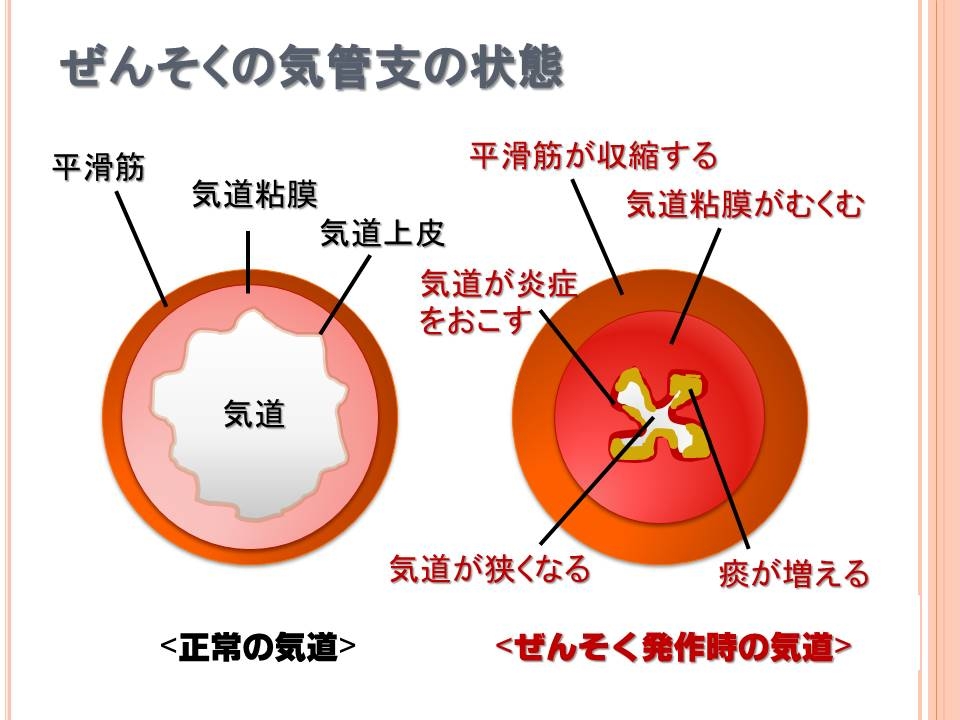 喘息模式図