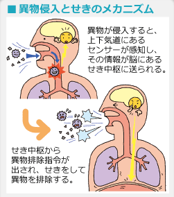 異物排除