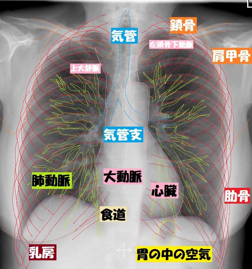 胸部レントゲン正常像の解説