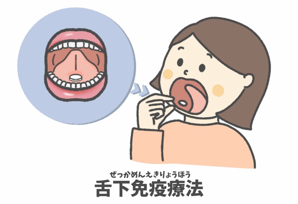 アレルギーの起こる仕組み